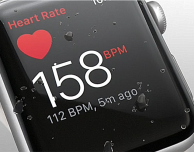 Apple Watch salva la vita ad un ragazzo di New York