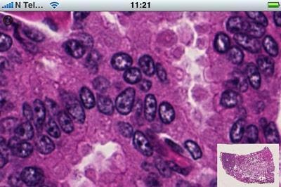 504x_9_-_interpath 504x_9_-_interpath