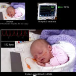 Una tecnologia sviluppata al MIT è in grado di registrare il battito cardiaco tramite la fotocamera dell’iPhone