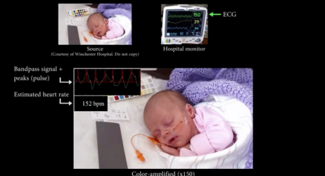 Una tecnologia sviluppata al MIT è in grado di registrare il battito cardiaco tramite la fotocamera dell’iPhone