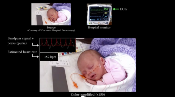 Una tecnologia sviluppata al MIT è in grado di registrare il battito cardiaco tramite la fotocamera dell’iPhone