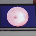 Utilizzare l’iPhone 3G come strumento oftalmologico
