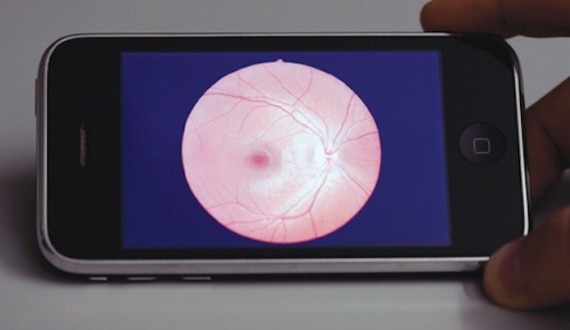 Utilizzare l’iPhone 3G come strumento oftalmologico
