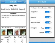 HalluxValgus: l’app per i medici ortopedici, fisiatri e fisioterapisti arriva su iPhone