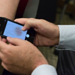 L’iPhone per scoprire il cancro alla pelle: i primi test sono positivi