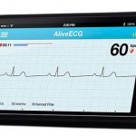 AliveCor: l’accessorio in grado di registrare l’elettrocardiogramma