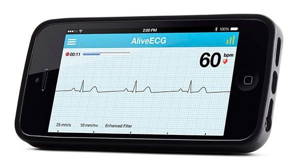 AliveCor: l’accessorio in grado di registrare l’elettrocardiogramma