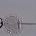 Mamme o carriera? Le dipendenti Apple possono ricevere il congelamento gratuito degli ovuli