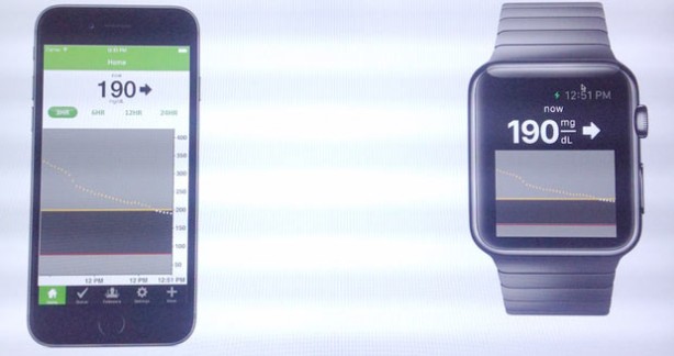 Apple Watch potrebbe supportare un’app per il monitoraggio del glucosio già dal lancio!