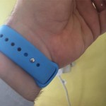 Apple Watch: nuovo caso di allergia in Italia