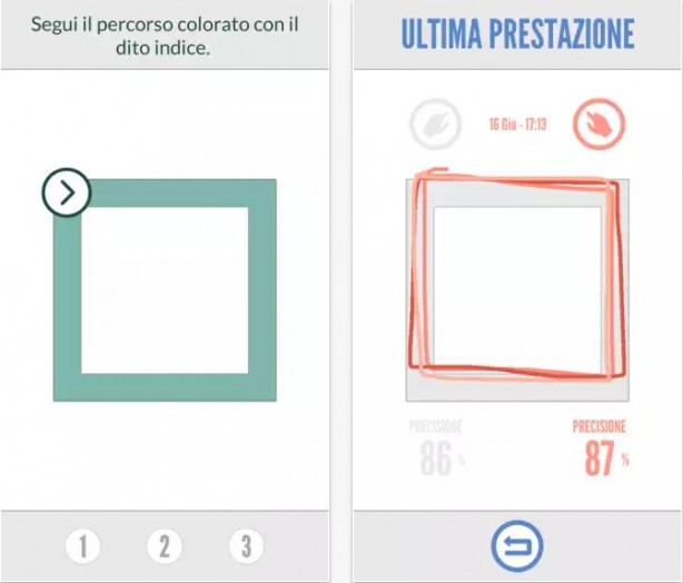 MotorBrain: misurare la qualità del controllo motorio delle mani