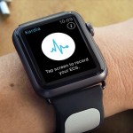 AliveCor presenta un cinturino per Apple Watch capace di eseguire misurazioni di grado clinico