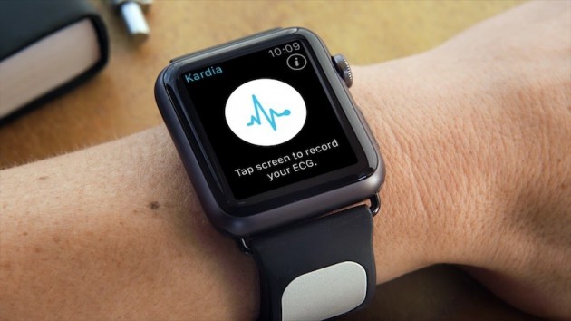 AliveCor presenta un cinturino per Apple Watch capace di eseguire misurazioni di grado clinico