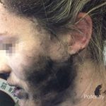 Apple: “Le cuffie esplose in volo erano nostre, ma…”