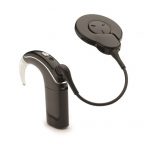 Disponibile il primo impianto cocleare MFi per iPhone