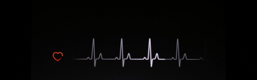 Apple Watch salva dall'infarto un uomo a Roma - iPhone Italia