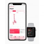 Apple collabora con la Zimmer Biomet per raccogliere nuovi dati medici con Apple Watch