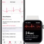 La funzione ECG su Apple Watch Series 4 arriverà con watchOS 5.1.2