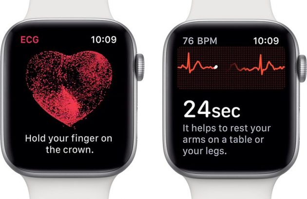 Apple Watch salva la vita a una donna diabetica