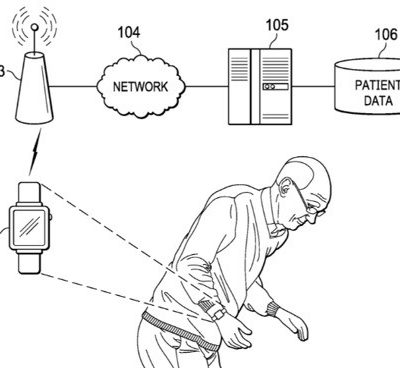 Il prossimo Apple Watch potrebbe aiutare a curare il Parkinson