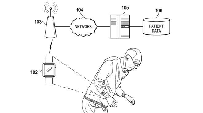 Il prossimo Apple Watch potrebbe aiutare a curare il Parkinson