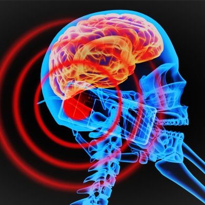 Gli smartphone non causano tumori, la conferma arriva dall’OMS