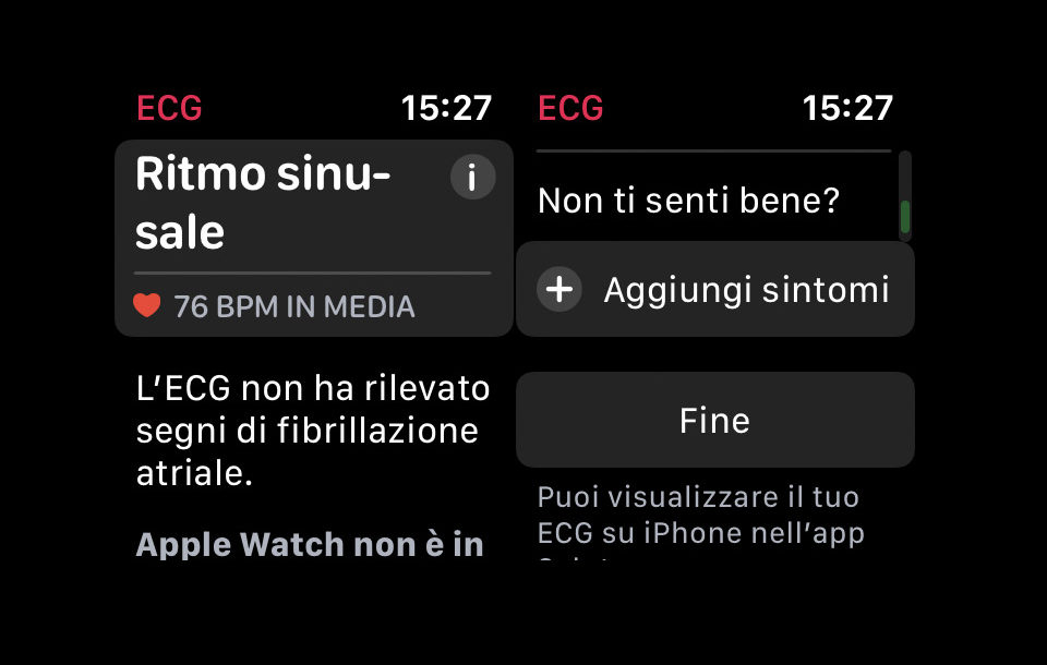 ECG Apple Watch: come attivare e usare la funzione - iPhone Italia