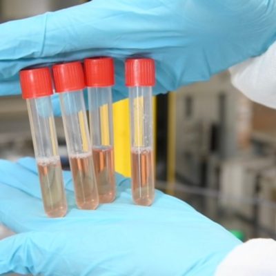 Apple investe 10 milioni di dollari in un’azienda produttrice di test COVID-19