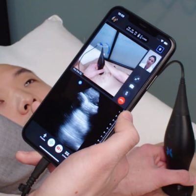 iPhone, app AR e dispositivo a ultrasuoni per diagnosticare COVID-19 anche a casa