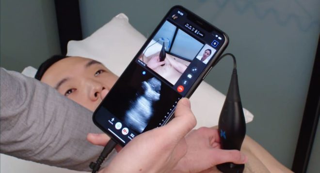 iPhone, app AR e dispositivo a ultrasuoni per diagnosticare COVID-19 anche a casa