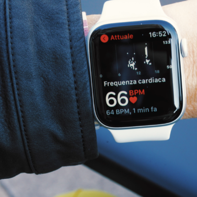 Il prossimo Apple Watch potrebbe misurare la pressione sanguigna