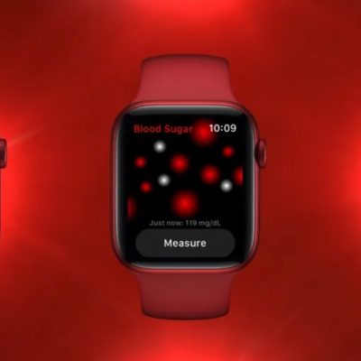 La FDA contro gli smartwatch che misurano il glucosio nel sangue in modo non invasivo