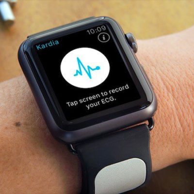 Apple vince la causa antitrust intentata da AliveCor
