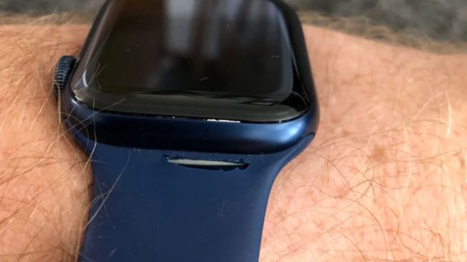 Alcuni utenti segnalano problemi con i cinturini Apple Solo Loop