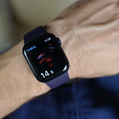 Il 30% degli utenti iPhone ha un Apple Watch