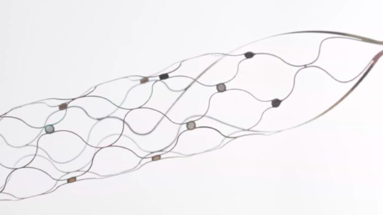 onde cerebrali iphone