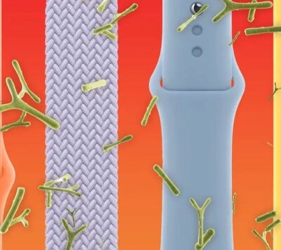 I batteri infestano i cinturini degli Apple Watch, come eliminarli?