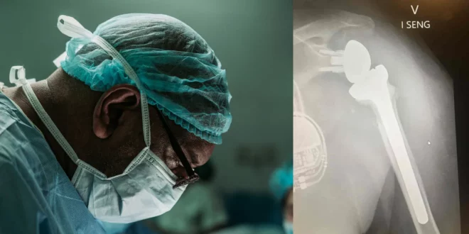 Il Vision Pro ha aiutato i chirurghi durante un’operazione alla spalla