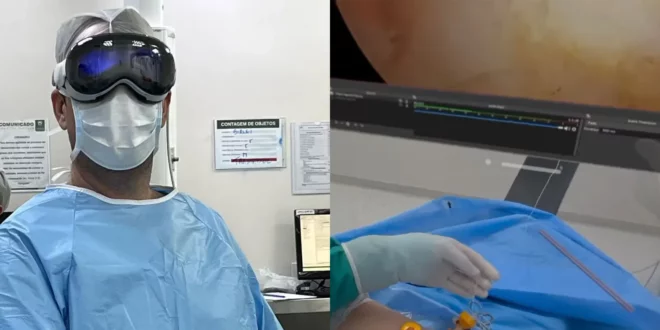 Apple Vision Pro utilizzato per assistere un medico durante un intervento di artroscopia