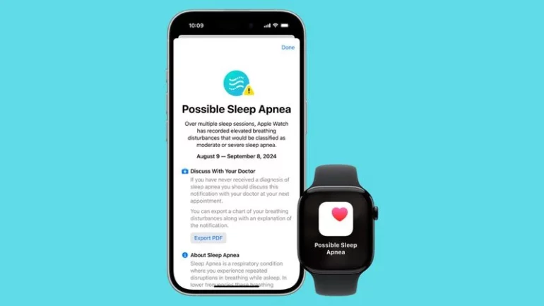 apnea notturna apple watch