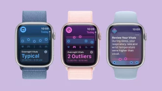 Apple prepara una nuova app per Apple Watch